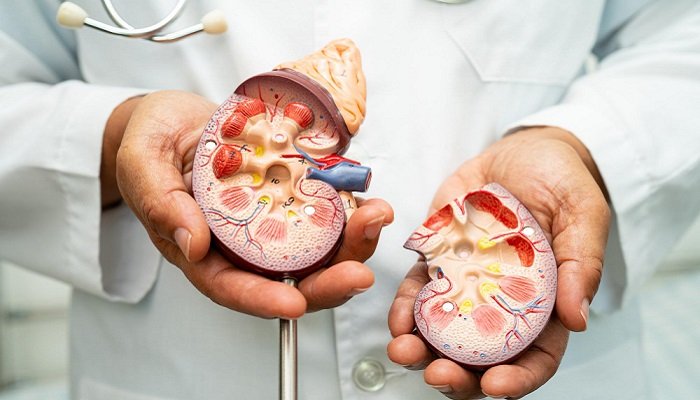 Kidney Transplant